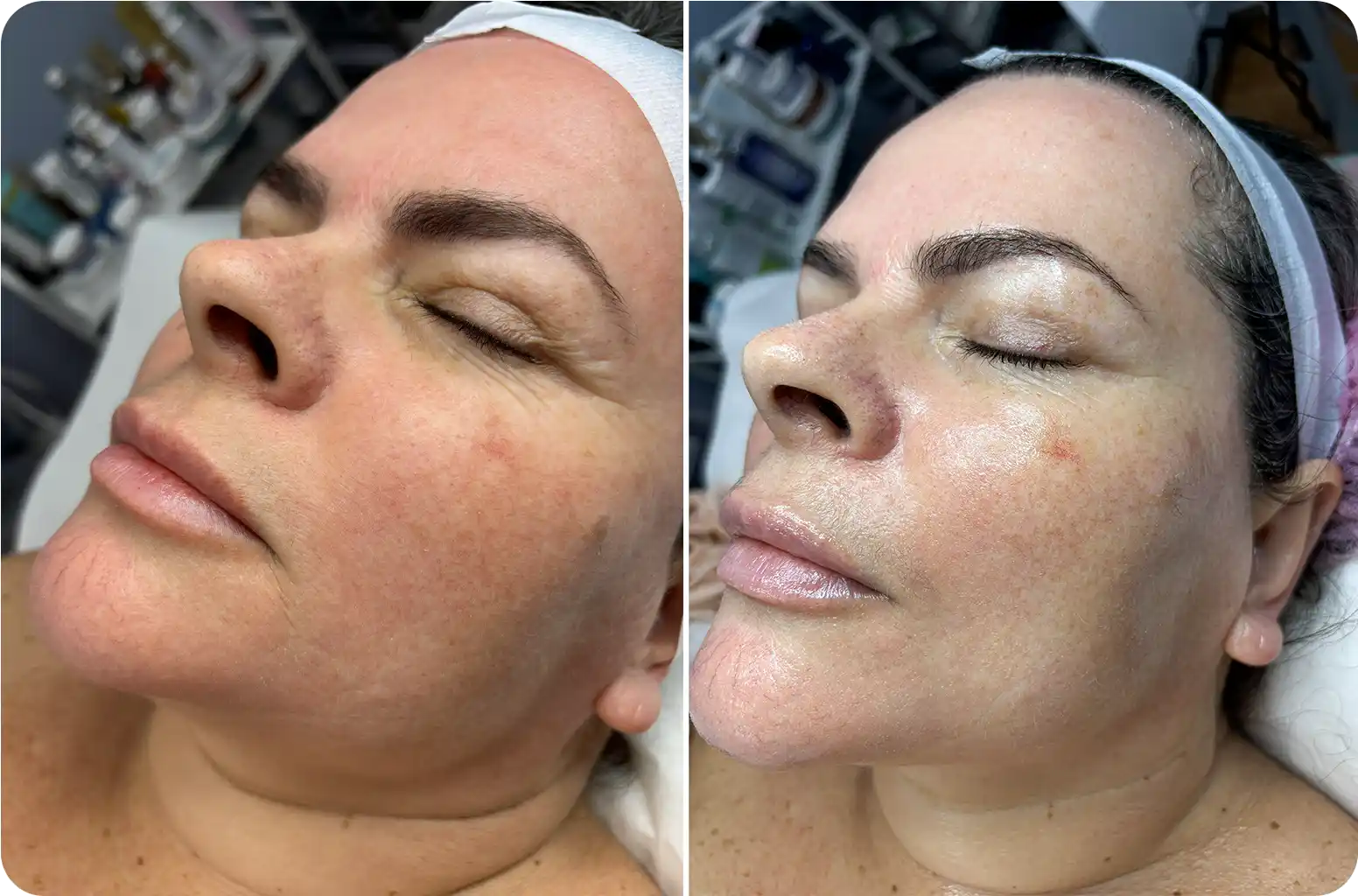 Patient Results 4